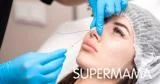 تجميل الأنف بالخيوط 